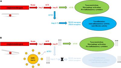 Speculation on the pathophysiology of musculoskeletal injury with COVID-19 infection